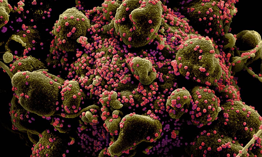 Imagem de microscópio eletrônico de varredura mostra célula infectada pelo vírus da Covid-19 (pontos rosa) Foto: NIAID-NIH