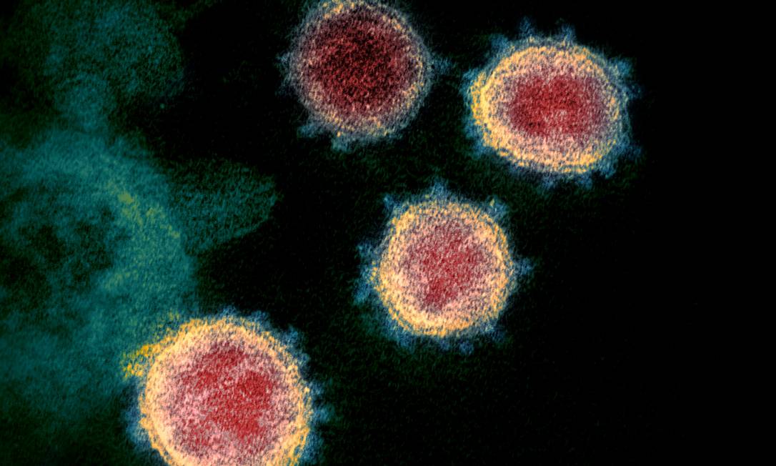 O Sars-CoV-2, vírus causador da Covid-19, visto em microscópio eletrônico; cientistas brasileiros vão testar em volunitários um antirretroviral usado no combate ao HIV, que já se mostrou eficaz contra o novo coronavírus em laboratório Foto: via REUTERS