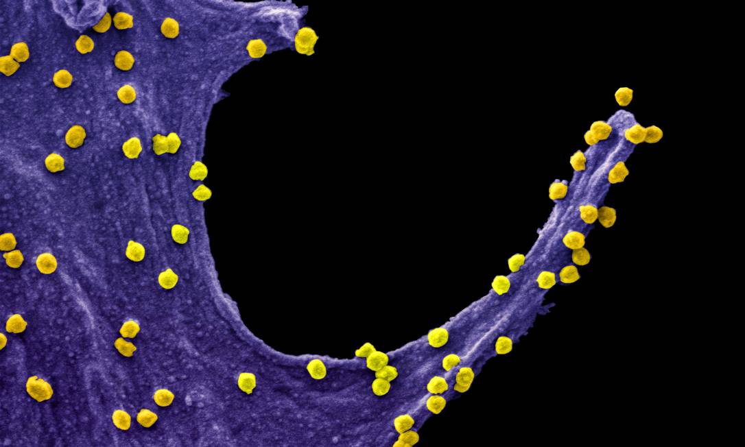 Imagem ampliada 84 mil vezes mostra o vírus Sars-Cov-2 (em amarelo), causador da Covid-19, atacando uma célula epitelial Foto: UFRJ / Divulgação
