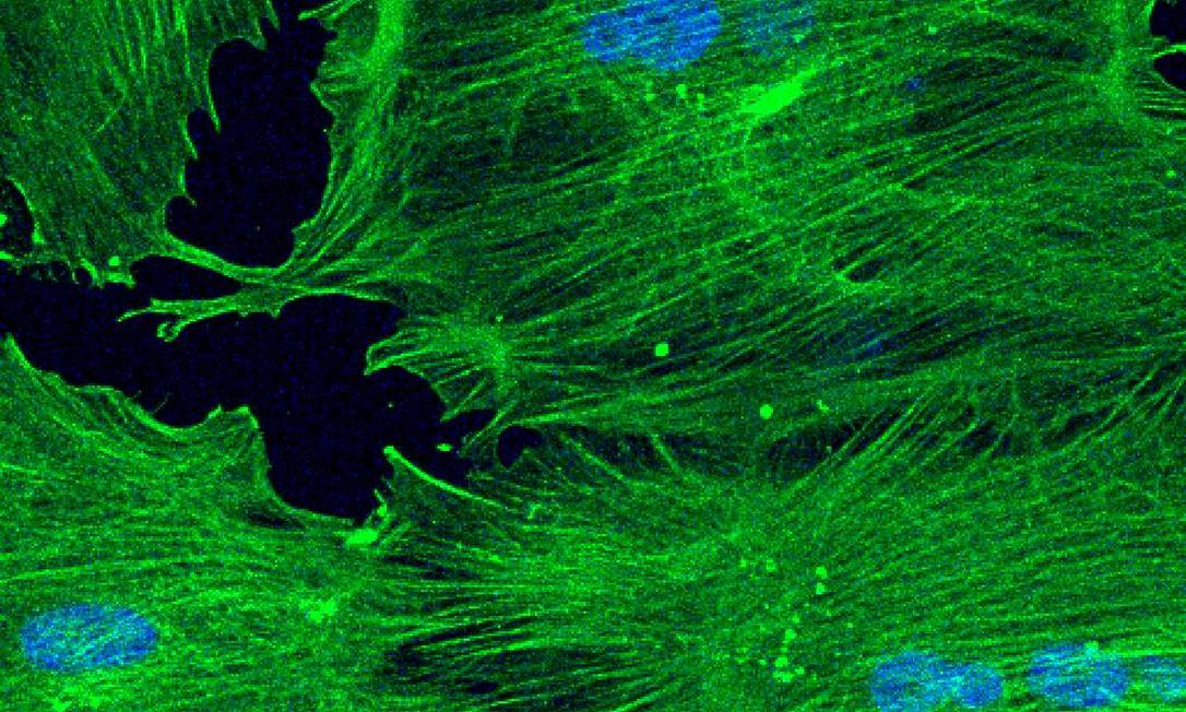 Imagem de microscópio mostra células-tronco mesenquimais, material biológico que está sendo usado em terapias para Covid-19 Foto: UCSF/NCATS