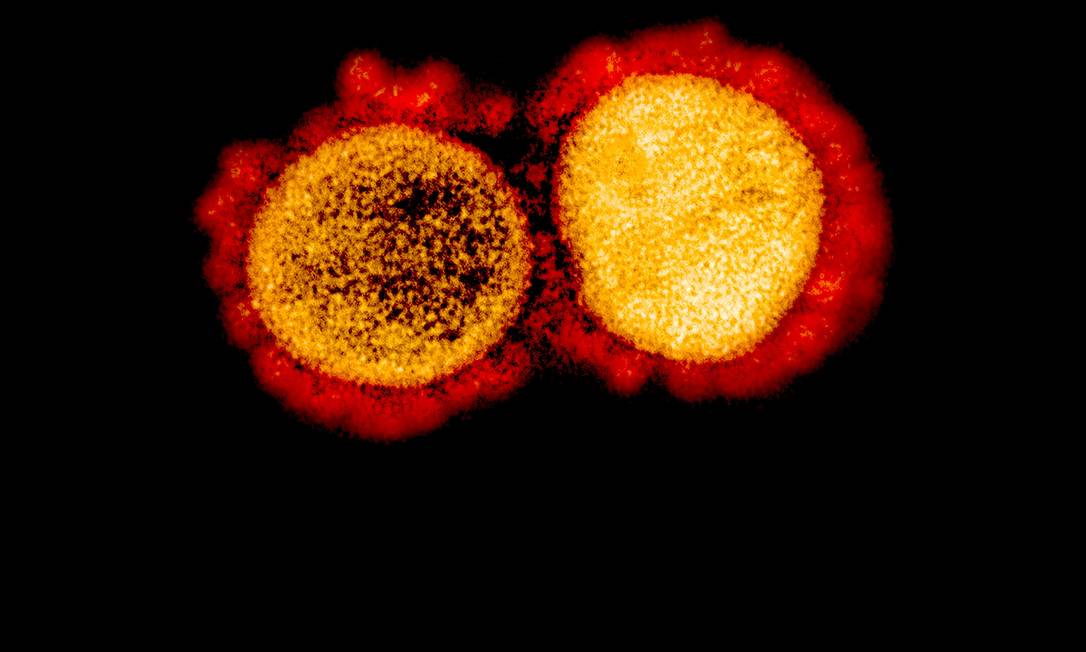 Partículas isoladas do vírus Sars-Cov-2, causador da Covid-19. Foto: HANDOUT / AFP