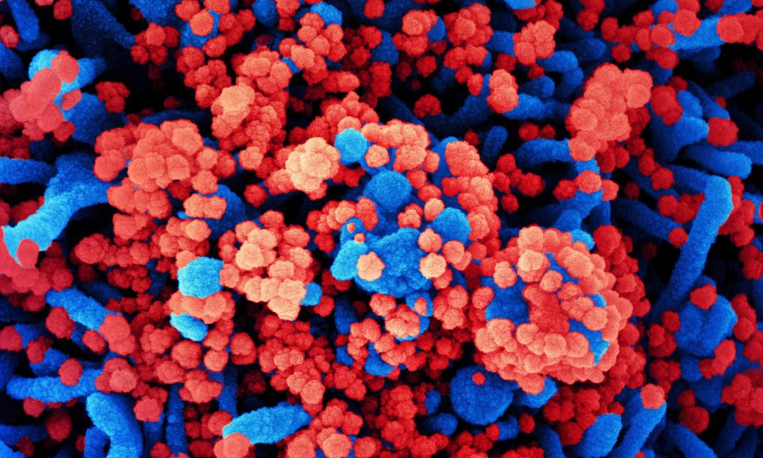 Imagem de microscópio colorizada artificialmente mostra célula humana (azul) infectada pelo vírus Sars-CoV-2 (vermelho) Foto: NIAID/NIH