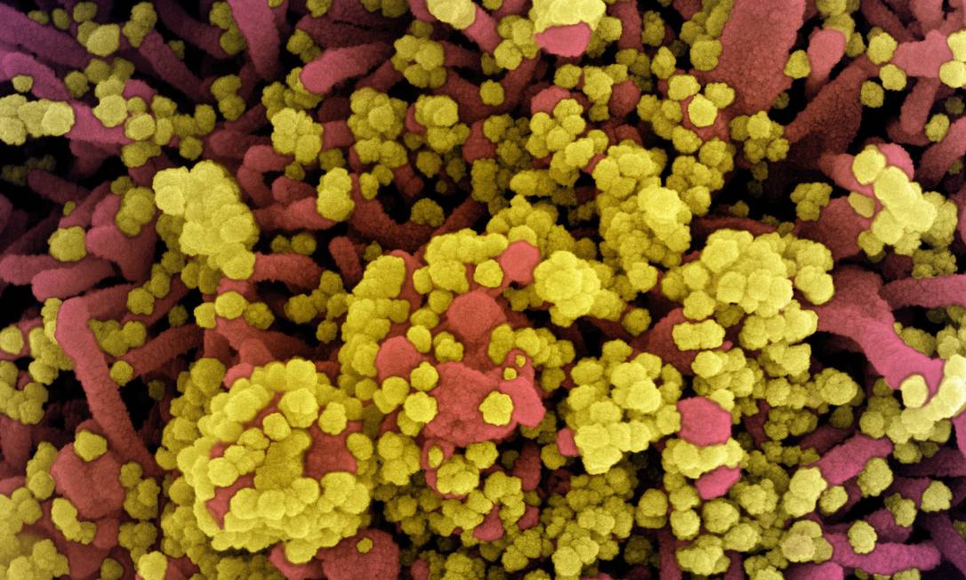 Imagem de microscópio colorizada artificialmente mostra unidades do novo coronavírus (amarelo) infectando célula humana (vermelho) Foto: NIAID/NIH