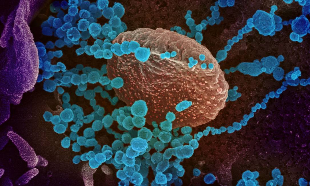 Imagem de microscópio mostrando o vírus Sars-CoV-2 emergindo de células cultivadas em laboratório pelo National Institutes of Health, dos EUA Foto: NATIONAL INSTITUTES OF HEALTH / AFP