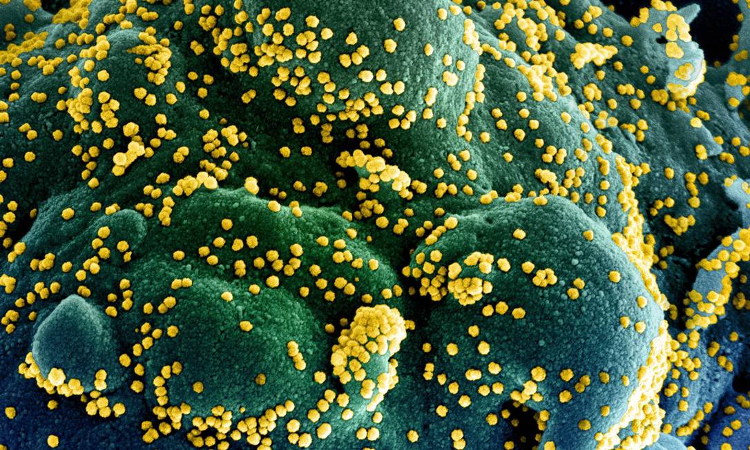 Imagem mostra uma célula infectada pelo Sars-CoV-2 (em amarelo) Foto: HANDOUT / AFP