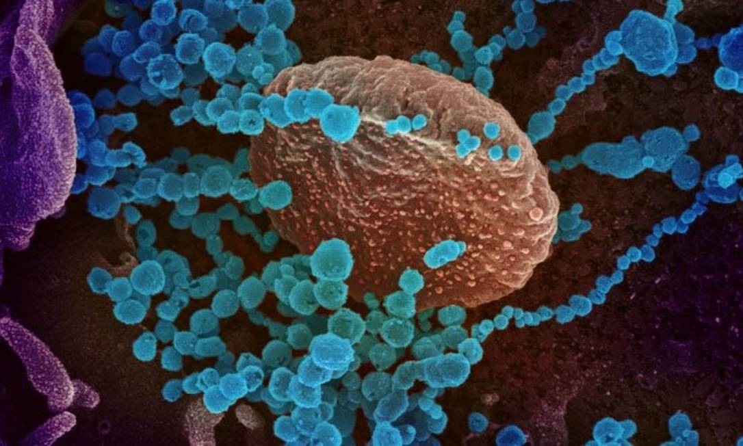 Imagem de microscópio mostrando o vírus Sars-CoV-2 emergindo de células cultivadas em laboratório pelo National Institutes of Health, dos EUA Foto: NATIONAL INSTITUTES OF HEALTH/AFP