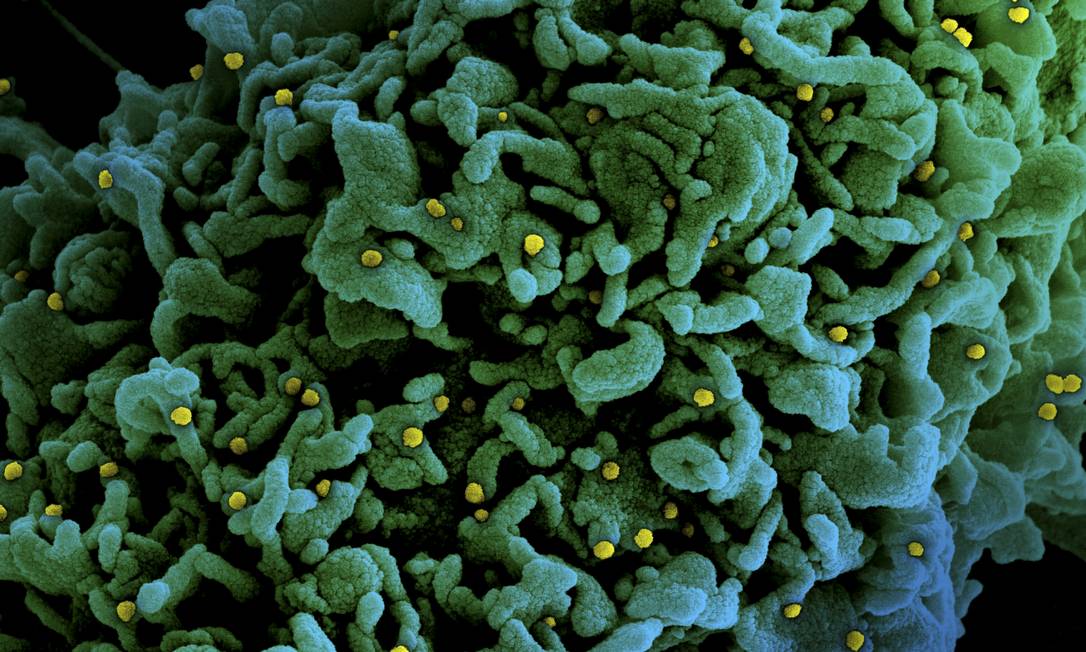 Micrografia eletrônica de varredura colorida de uma célula (verde) infectada com partículas do vírus SARS-CoV-2 variante do Reino Unido B.1.1.7 (amarelo), isolada de uma amostra de paciente. Imagem capturada no Centro de Pesquisa Integrada (IRF) do NIAID em Fort Detrick, Maryland. Foto: Agência O Globo