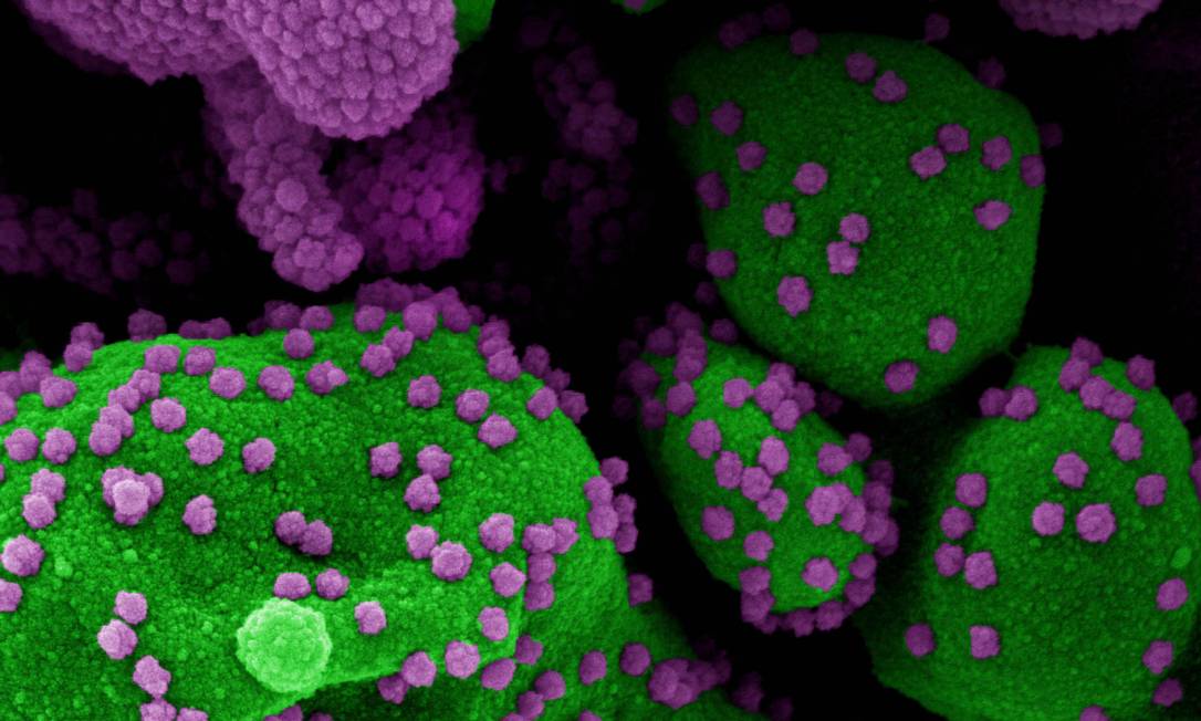 Imagem mostra celula infectada pelo Sars-CoV-2 (em roxo), nos EUA Foto: HANDOUT / AFP