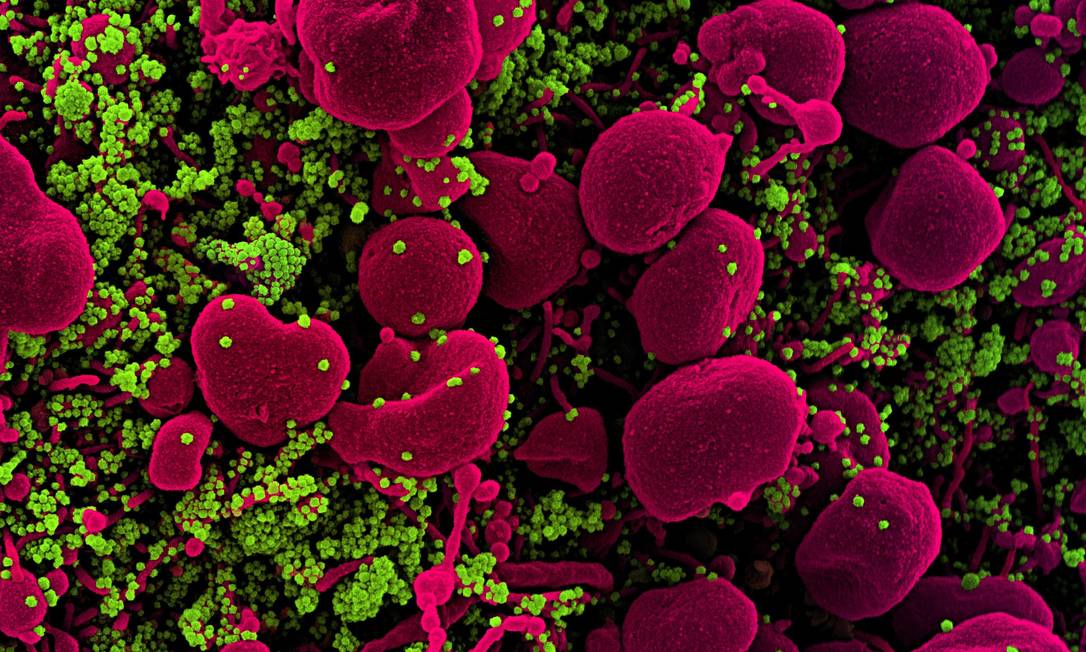 Imagem de microscópio eletrônico colorizada artificialmente mostra célula humana (vermelho) infectada pelo coronavírus (verde) Foto: NIAID-NIH