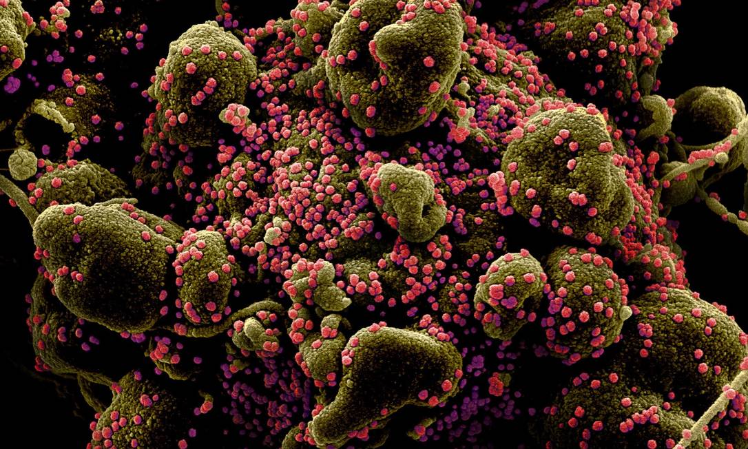 Imagem ilustrativa de micrografia eletrônica de varredura colorida de uma célula infectada com partículas do vírus SARS-COV-2 (rosa), também conhecido como novo coronavírus. Imagem capturada e aprimorada com cores no NIAID Integrated Research Facility (IRF) Foto: NIAID / via REUTERS