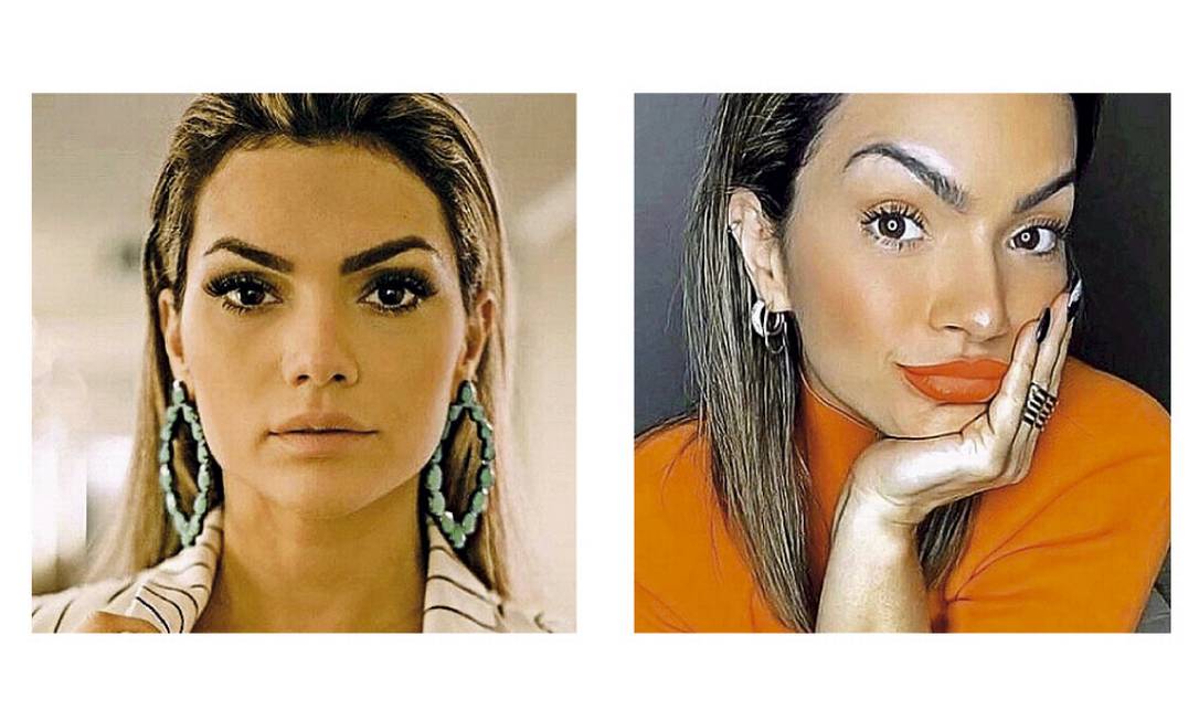 Confira o antes e depois de famosos que fizeram harmonização facial Jornal O Globo