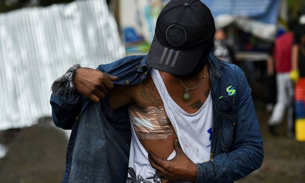 Manifestante mostra um ferimento adquirido durante confrontos com a polícia de choque durante um protesto contra o governo em Yumbo, Colômbia Foto: LUIS ROBAYO / AFP