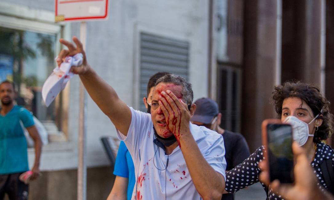 Homem é ferido no olho por tiro de bala de borracha disparado pela PM Foto: INSTAGRAM @hugomunizzz/REUTERS