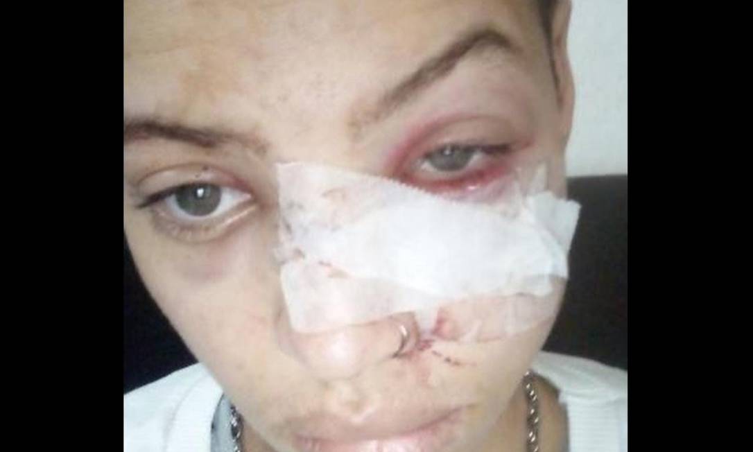Luan Brandão Neto recebeu golpes de facão no rosto e nas mãos Foto: Reprodução