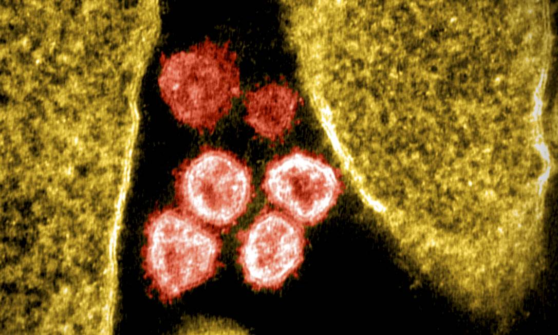 Imagem de microscópio mostra partículas de SARS-CoV-2 emergindo da superfície de uma célula cultivada em laboratório Foto: NIAID
