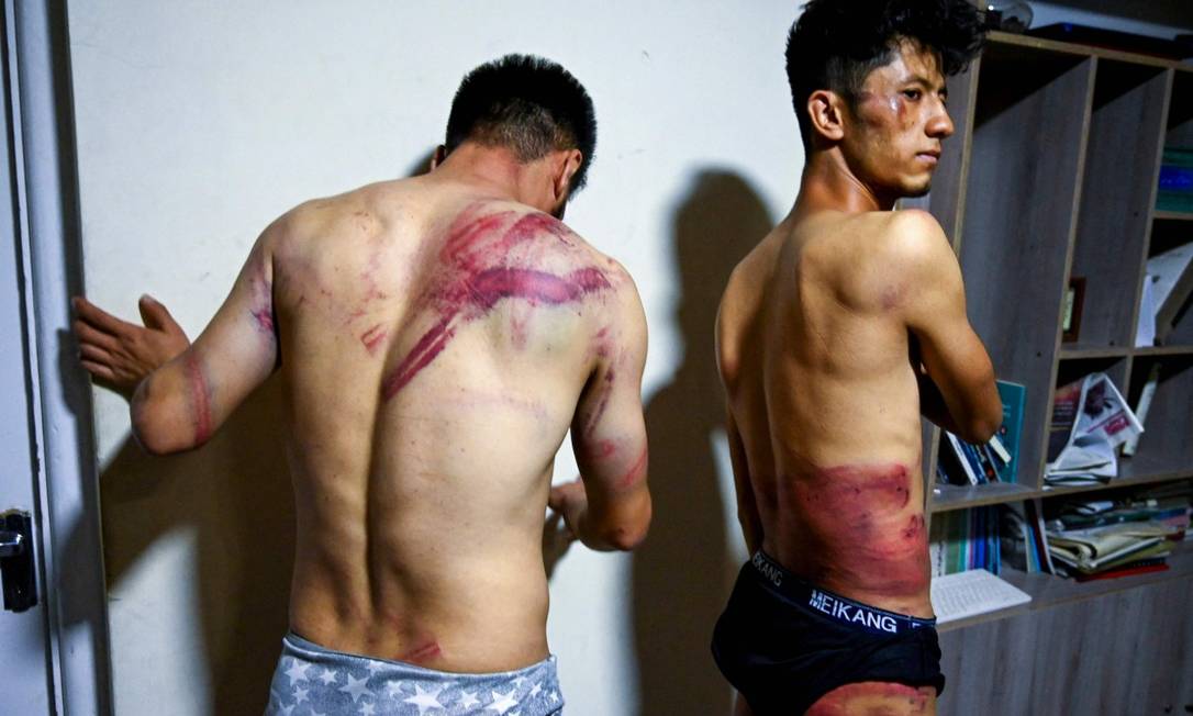 Jornalistas do periódico Etilaatroz, Neamat Naqdi (esquerda) e Taqi Daryabi, mostram ferimentos Foto: WAKIL KOHSAR / AFP