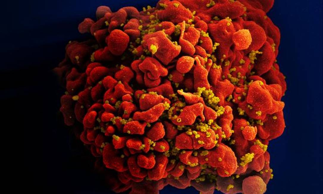 Micrografia eletrônica mostra uma célula T H9 infectada com HIV. Foto: NIAID/NIH/Divulgação