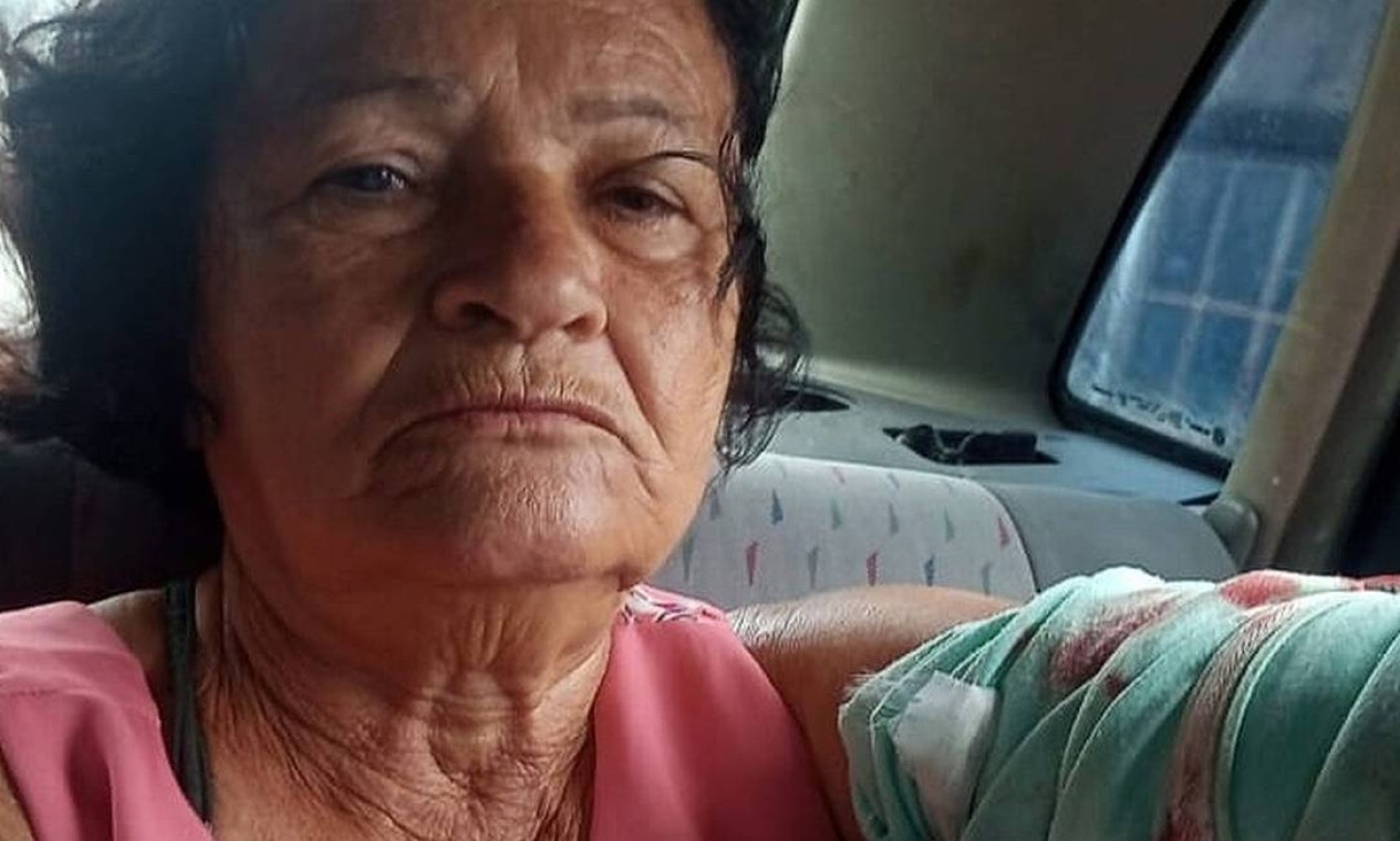 Carmelita Francisca de Oliveira, de 71 anos, foi baleada no fim da manhã deste domingo, no Complexo do Salgueiro. Ela foi atingida no braço esquerdo durante uma ação do Bope na região Foto: Reprodução