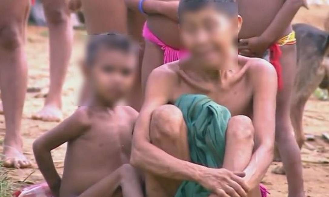 MPF afirma que há mais crianças ianomâmis desnutridas do que saudáveis Foto: Reprodução / G1