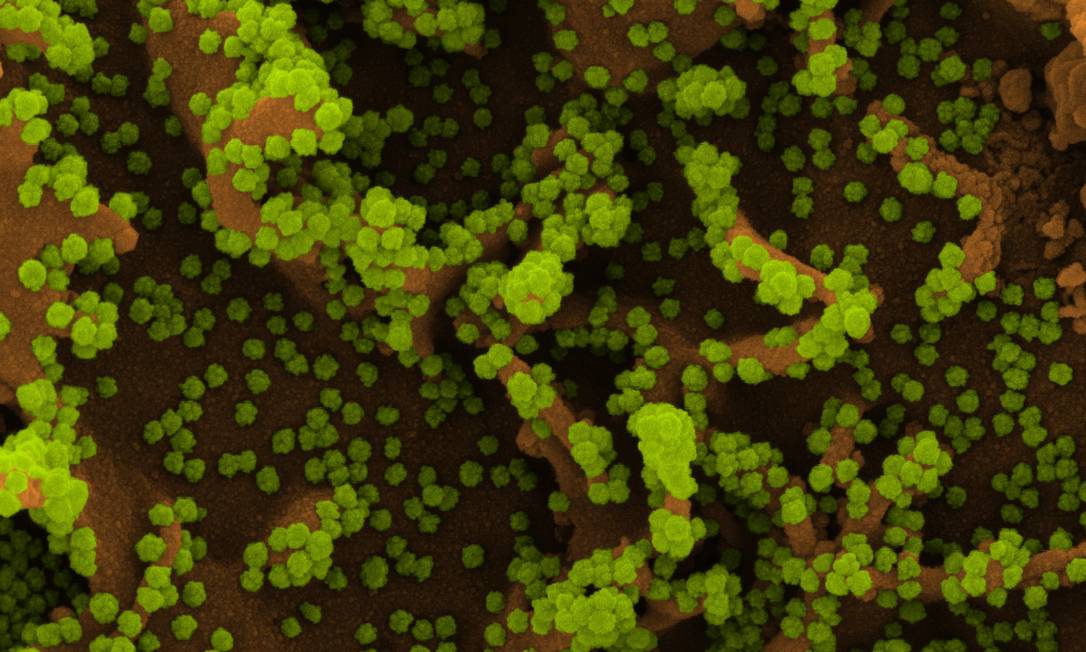 Micrografia eletrônica de varredura colorida de uma célula (marrom) fortemente infectada com partículas do coronavírus (Sars-CoV-2, em verde), isolada de uma amostra de paciente. Foto: NIH/NIAID