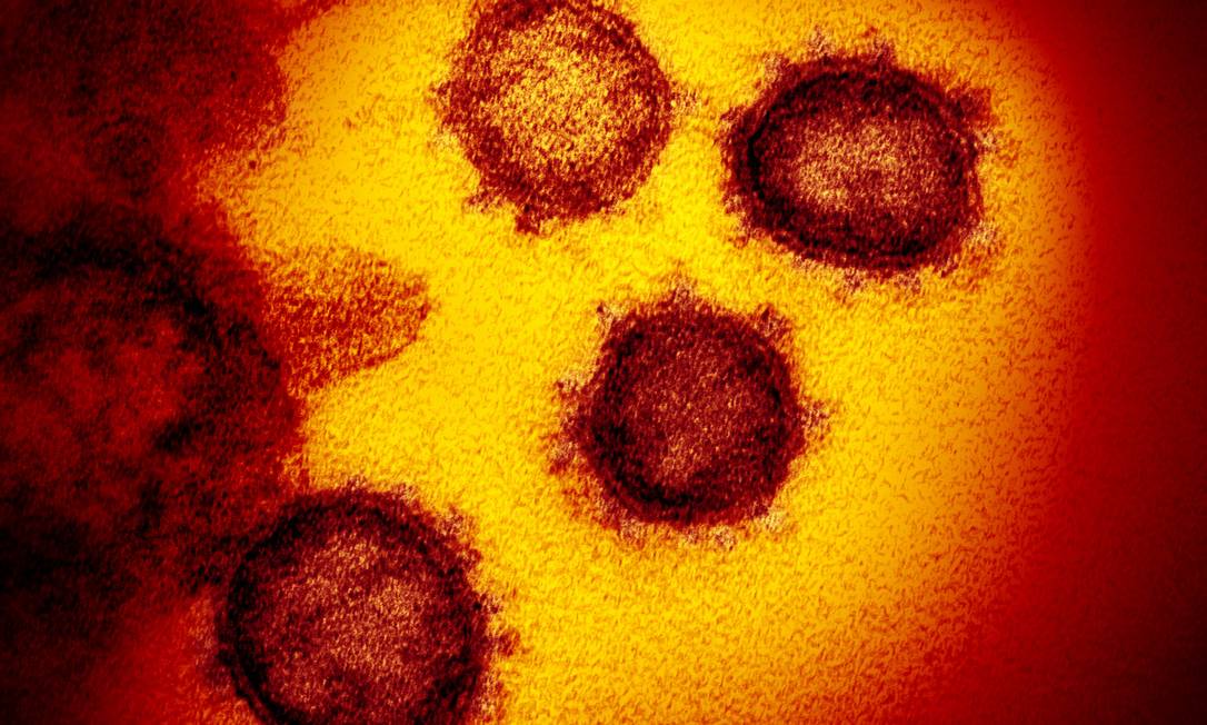 Imagem do microscópio eletrônico mostra coronavírus infectando células cutivadas em laboratório. Foto: NIAID/NIH