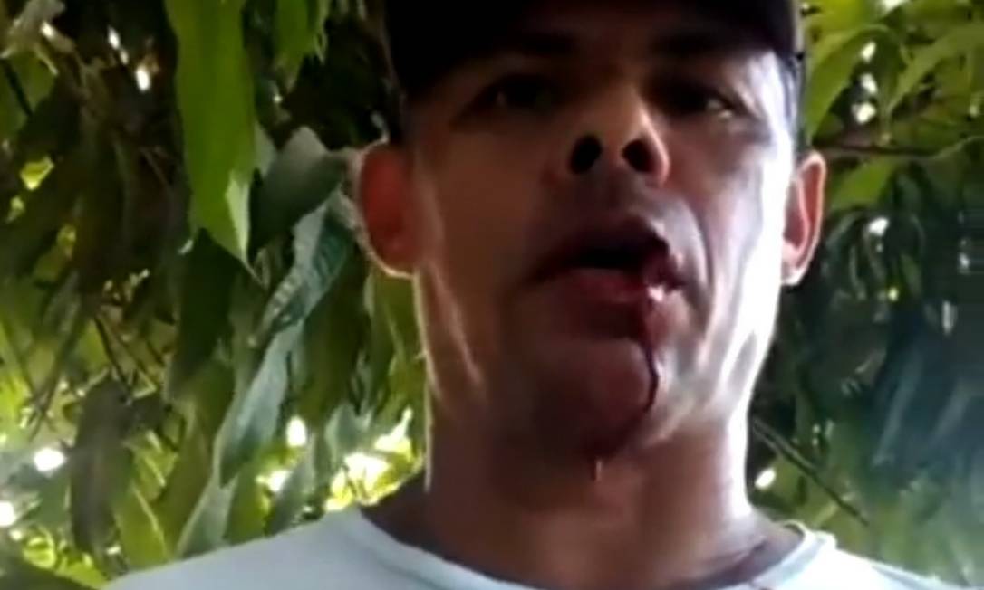 Valdir Cunha de Maceno, de 50 anos, levou 30 pontos no rosto após ter sido agredido em bar Foto: Reprodução
