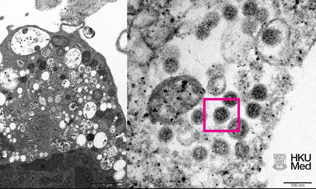 Cientistas de Hong Kong revelam imagem de microscópio da variante Ômicron Foto: Reprodução/ Universidade de Hong Kong