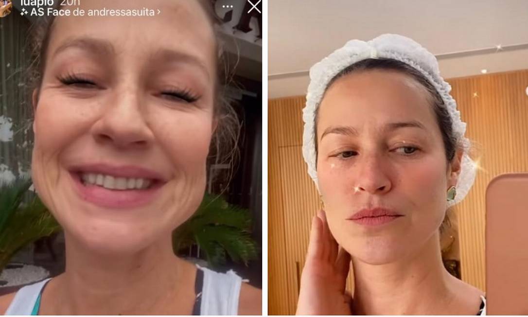 Luana Piovani antes da harmonização facial (à esquerda) e depois Foto: Instagram / Reprodução