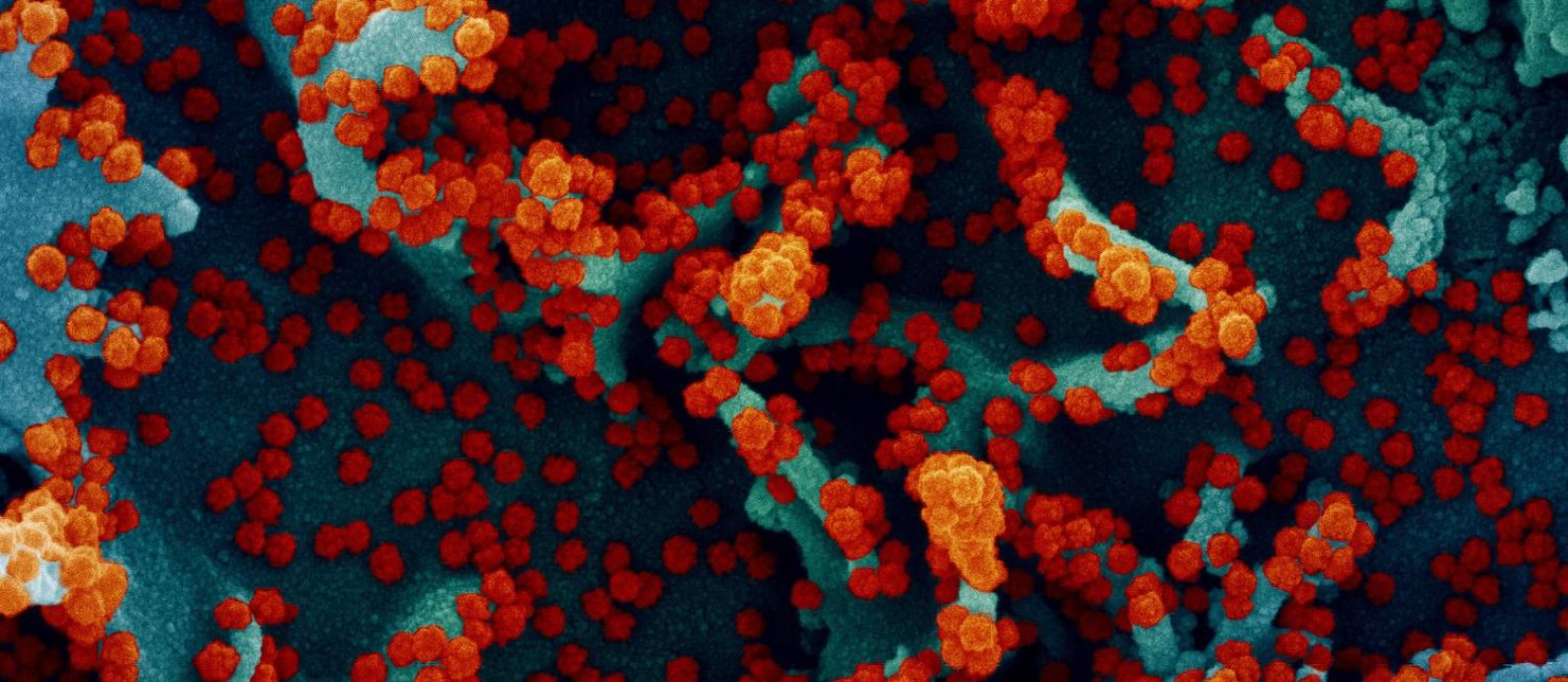 Micrografia eletrônica de varredura colorida mostra célula fortemente atacada pelo SARS-Cov-2 (em vermelho) Foto: NIH/Divulgação