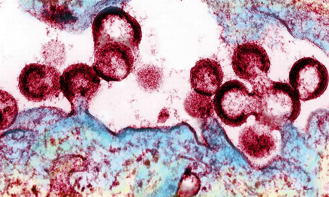 Amostra de células humanas infectadas pelo HIV Foto: NIAID-NIH