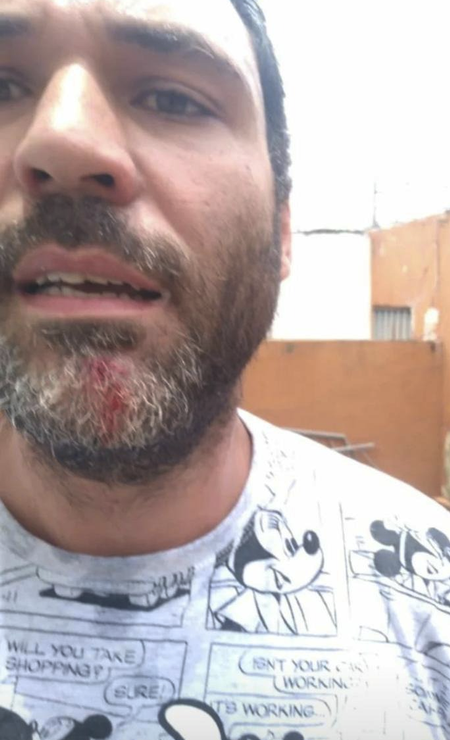 Matheus mostra ferimento na boca, depois que foi atingido por ataque do vizinho com uma barra de ferro Foto: Arquivo pessoal