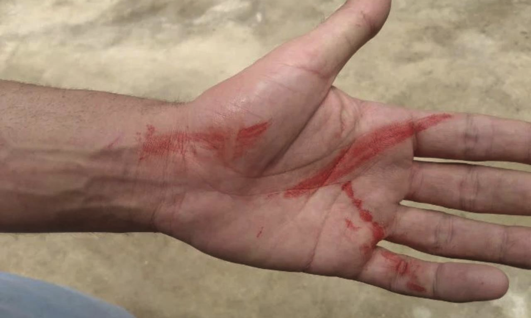 Marcas de sangue nas mãos de Matheus após discussão com vizinho que disparou xingamentos homofóbicos contra ele e o namorado Foto: Reprodução
