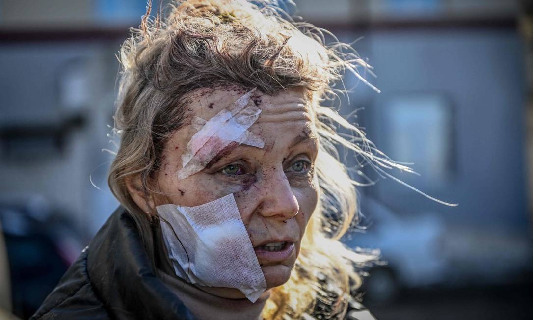 Mulher ferida durante bombardeio da cidade de Chuguiv, no leste da Ucrânia Foto: ARIS MESSINIS / AFP