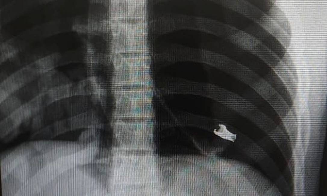 Corpo de Cauã tinha fragmento de um projétil de fuzil Foto: Divulação