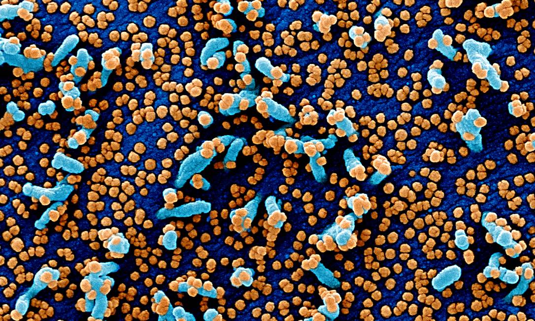 Sars-CoV-2: vírus recombinante traz material genético de duas cepas Foto: NIAID