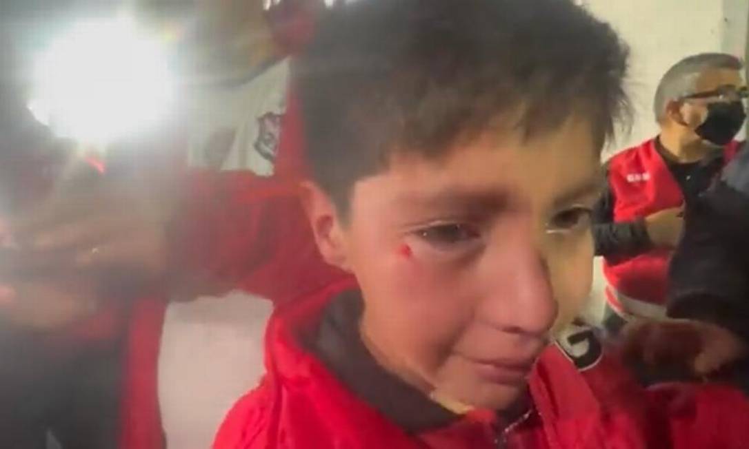 O pequeno Thiago, de 10 anos, chora após ser atingido por sinalizador Foto: Reprodução