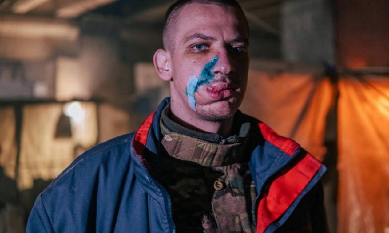 Militar ucraniano com ferimentos na boca Foto: AZOV REGIMENT PRESS SERVICE / via REUTERS