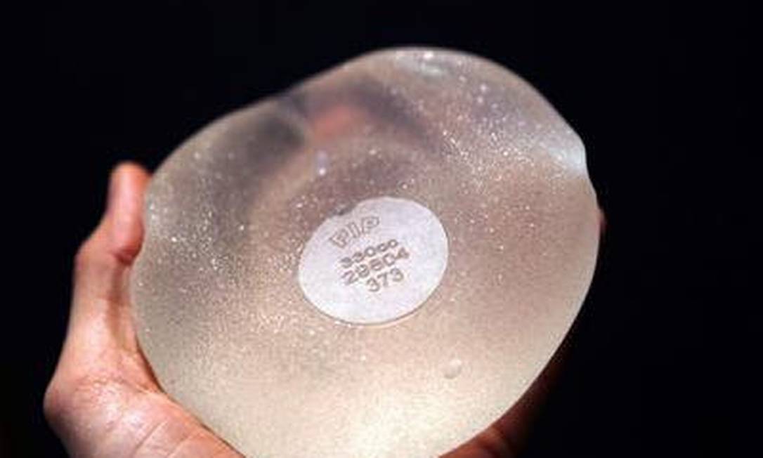 O implante francês PIP: silicone industrial misturado ao usado clinicamente Foto: AFP
