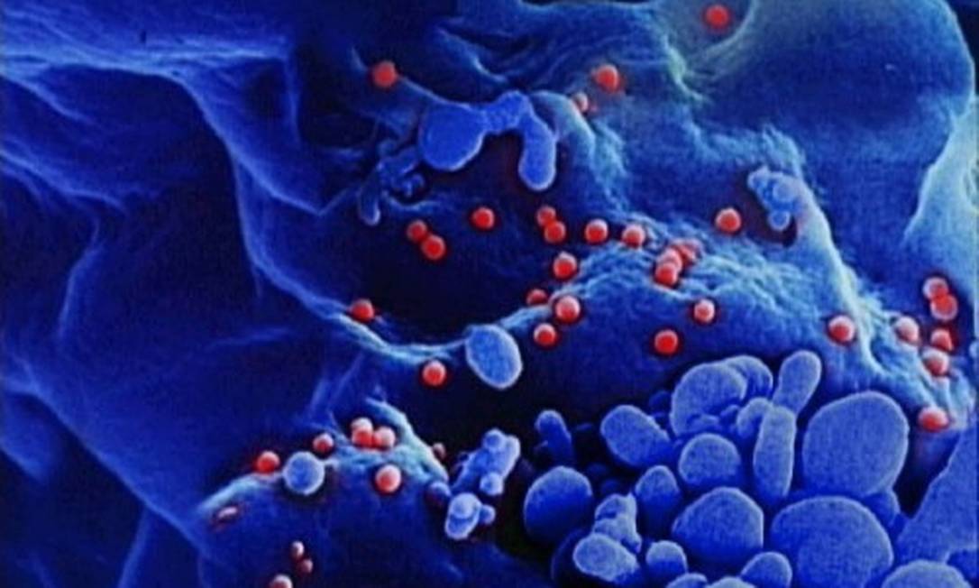 
Vírus HIV infecta células do sistema imunológico
Foto: Divulgação / HIV Boehringer-Ingelheim