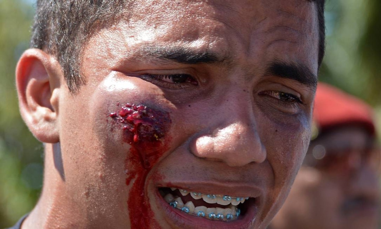A demonstrator bleeds after being wounded on the face during clashes between riot police officers and protesters who blocked access to the Castelao Stadium in Fortaleza, where Brazil is to play Mexico in a FIFA Confederations Cup Brazil 2013 football match, to denounce the events' $15 billion price-tag, on June 19, 2013. Some of the roughly 10,000 protesters at the site hurled stones at security forces, who responded with tear gas and rubber bullets. Brazil deployed special federal police Wednesday to protect Confederations Cup venues, as mass "Tropical Spring" protests against government spending for the 2014 World Cup turn violent. AFP PHOTO / VANDERLEI ALMEIDA Foto: VANDERLEI ALMEIDA / AFP