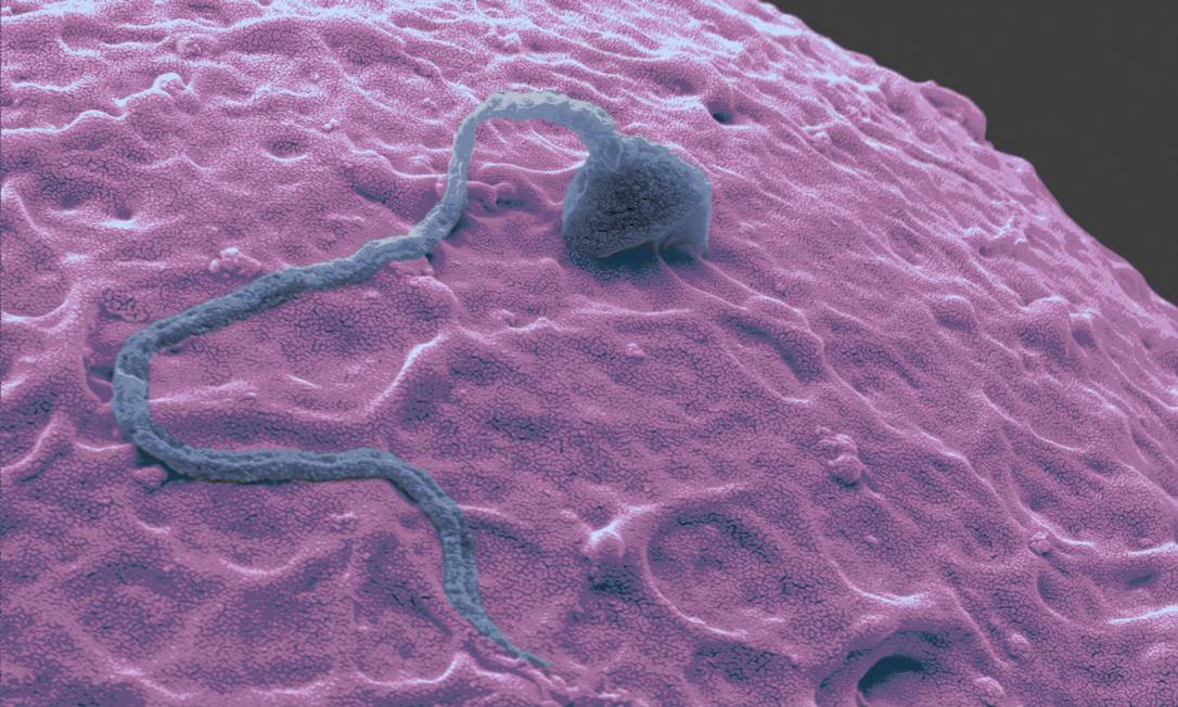 
Ilustração mostra espermatozoide fecundando óvulo; pesquisa ainda demorará a ser aplicada em humanos, estimam especialistas
Foto: Agência O Globo