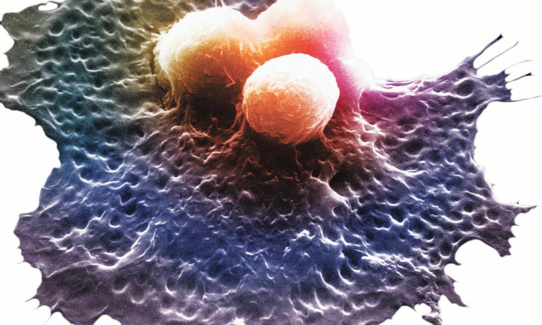 
Célula cancerosa. Compreensão do tumor mudou muito no último século
Foto: Terceiro / Latinstock/Science VU/W. J. Johnson