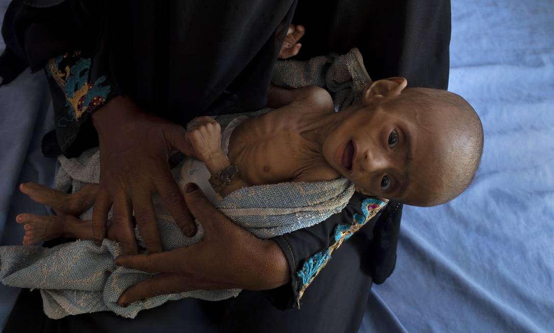 Com cinco meses de idade, Ahmed Ibrahim al Junid sofre de severa desnutrição Foto: TYLER HICKS/NYT