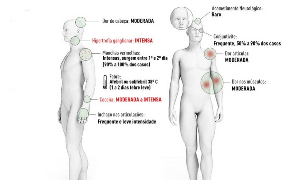 Conheça os sintomas do Zyka Foto: Reprodução/Ministério da Saúde
